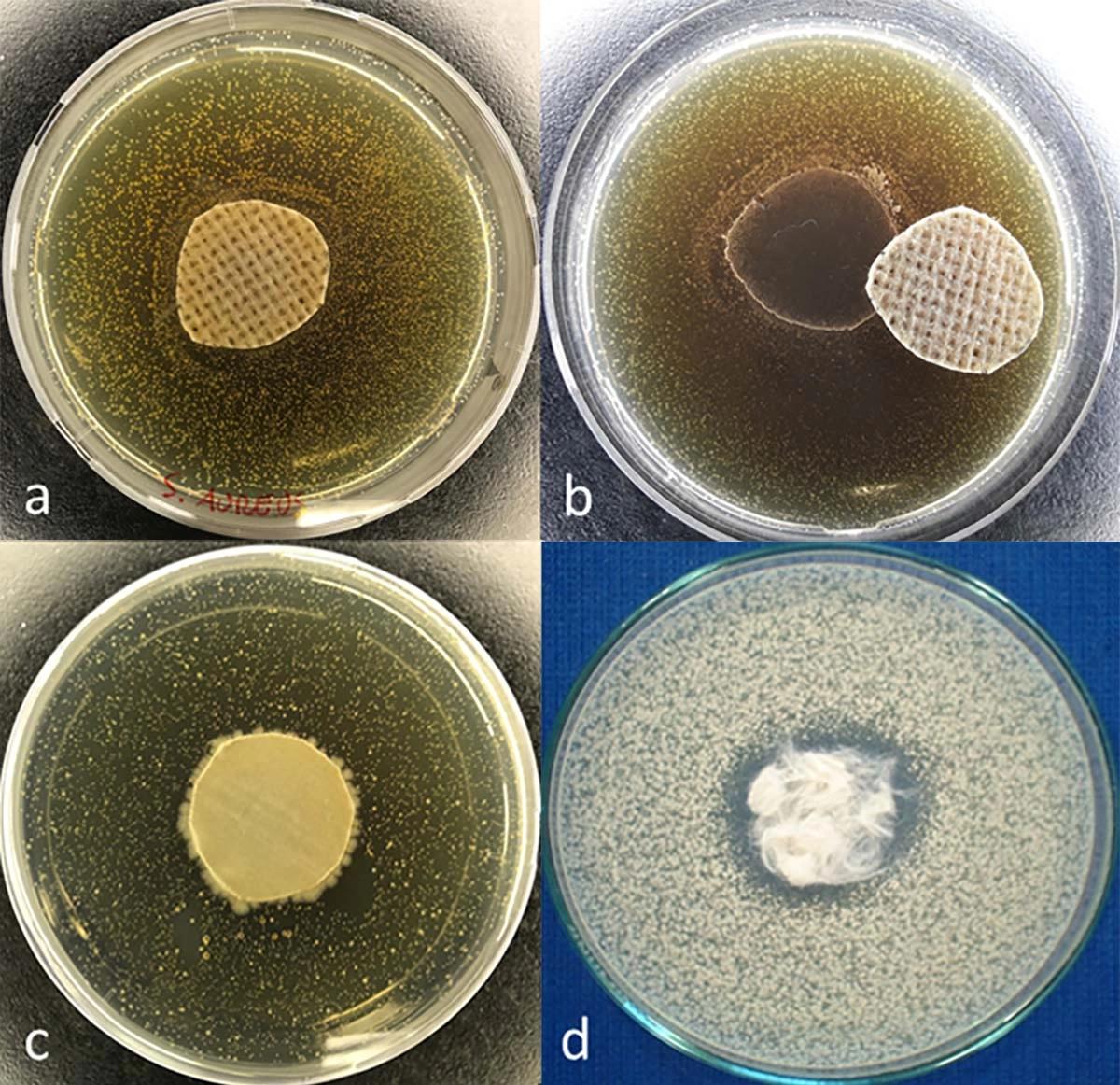 Bacteria Catcher presence results